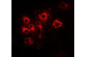 Immunofluorescent analysis of Tapasin staining in Hela cells. (TAPBP antibody  (full length))