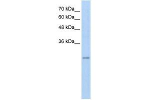 RFPL3 antibody used at 5 ug/ml to detect target protein. (RFPL3 antibody  (Middle Region))