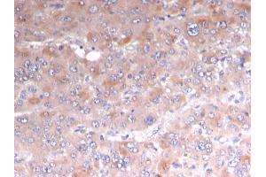 Formalin-fixed, paraffin-embedded human Adrenal stained with Adipophilin Recombinant Mouse Monoclonal Antibody (rADFP/1493).