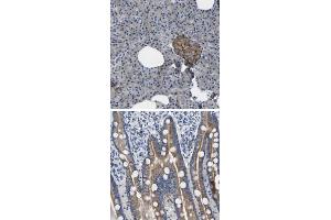 Immunohistochemical staining of human duodenum with TOR1B polyclonal antibody  shows moderate cytoplasmic positivity in glandular cells.