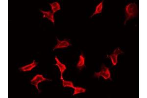 ABIN6267546 staining HeLa by IF/ICC. (VASP antibody  (pSer157))