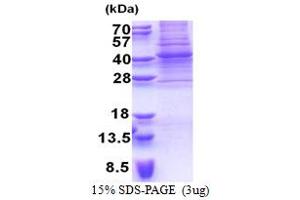SDS-PAGE (SDS) image for Paired Box 9 (PAX9) (AA 1-341) protein (His tag) (ABIN5853281)