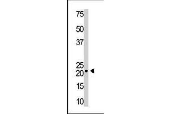 VSNL1 antibody  (AA 129-159)