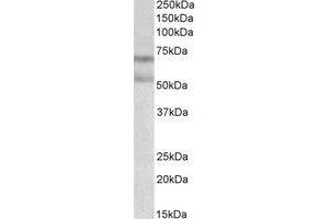 Western Blotting (WB) image for anti-Cannabinoid Receptor 1 (CNR1) (AA 77-91) antibody (ABIN793332) (CNR1 antibody  (AA 77-91))
