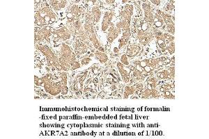Image no. 1 for anti-Aflatoxin Beta1 Aldehyde Reductase (AKR7A2) antibody (ABIN791187) (AKR7A2 antibody)