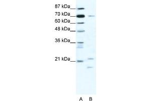 WB Suggested Anti-BTF3 Antibody Titration:  1. (BTF3 antibody  (Middle Region))