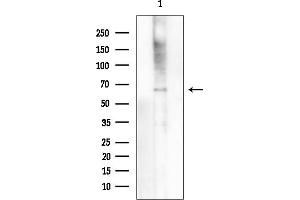 Western blot analysis of lysates from Rat brain, using N4BP2L2 Antibody at 1/1000 dilution.