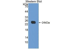 Detection of Recombinant APOE, Canine using Polyclonal Antibody to Apolipoprotein E (APOE) (APOE antibody  (AA 1-172))