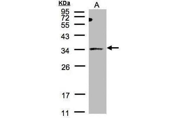 ST3GAL1 antibody