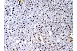 IHC analysis of VEGF Receptor 3 using anti-VEGF Receptor 3 antibody . (FLT4 antibody  (AA 25-259))