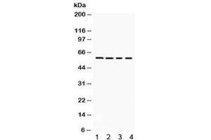 Western blot testing of 1) rat kidney, 2) rat brain, 3) mouse brain, 4) mouse kidney lysate with Kv1. (KCNA2 antibody)