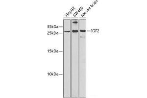 Western blot analysis of extracts of various cell lines using IGF2 Polyclonal Antibody at dilution of 1:1000. (IGF2 antibody)