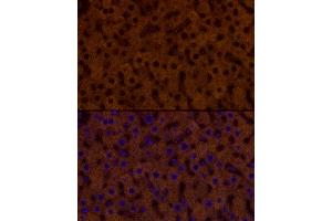 Immunofluorescence analysis of rat liver cells using PAH Rabbit mAb (ABIN7269264) at dilution of 1:25 (40x lens). (Phenylalanine Hydroxylase antibody)