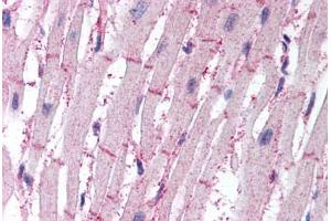 Human Heart (formalin-fixed, paraffin-embedded) stained with ATG4B antibody ABIN295502 at 10 ug/ml followed by biotinylated goat anti-rabbit IgG secondary antibody ABIN481713, alkaline phosphatase-streptavidin and chromogen. (ATG4B antibody  (AA 350-400))
