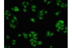 Immunofluorescent analysis of HepG2 cells using ABIN7159609 at dilution of 1:100 and Alexa Fluor 488-congugated AffiniPure Goat Anti-Rabbit IgG(H+L) (MBD1 antibody  (AA 106-355))