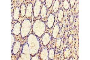 Immunohistochemistry of paraffin-embedded human stomach tissue using ABIN7175770 at dilution of 1:100 (WDR54 antibody  (AA 1-334))