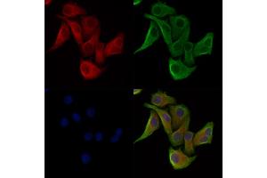 Phospho-MYPT1 (Ser852) Antibody staining Hela cells(heat shock treatment) by IF/ICC.