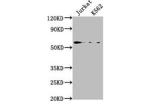 Western Blot Positive WB detected in: Jurkat whole cell lysate, K562 whole cell lysate All lanes: HMGXB4 antibody at 1:2000 Secondary Goat polyclonal to rabbit IgG at 1/50000 dilution Predicted band size: 66 kDa Observed band size: 66 kDa (HMGXB4 antibody  (AA 489-509))