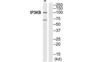 Western Blotting (WB) image for anti-Inositol-Trisphosphate 3-Kinase B (ITPKB) (Internal Region) antibody (ABIN1849284)