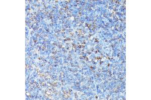 Immunohistochemistry of paraffin-embedded mouse spleen using CXCR1 antibody (ABIN7266317) at dilution of 1:100 (40x lens). (CXCR1 antibody  (AA 250-350))