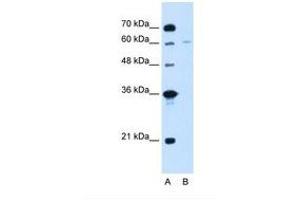 Image no. 2 for anti-Chromatin Assembly Factor 1, Subunit B (p60) (CHAF1B) (C-Term) antibody (ABIN320995) (CHAF1B antibody  (C-Term))