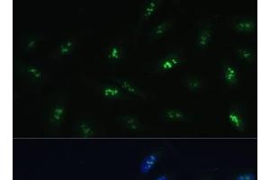 Immunofluorescence analysis of U-2 OS cells using HNF4G Polyclonal Antibody at dilution of 1:100 (40x lens). (HNF4 gamma antibody)