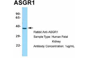 Host: Rabbit Target Name: ASGR1 Sample Type: Human Fetal Kidney Antibody Dilution: 1. (Asialoglycoprotein Receptor 1 antibody  (Middle Region))