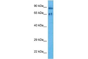 Host:  Rabbit  Target Name:  RIPK4  Sample Tissue:  Human HT1080 Whole Cell  Antibody Dilution:  1ug/ml (RIPK4 antibody  (Middle Region))