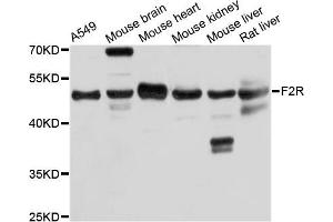 Western blot analysis of extracts of various cell lines, using F2R antibody. (PAR1 antibody)