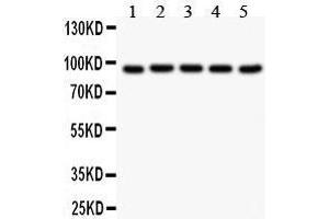 Western Blotting (WB) image for anti-Villin 1 (VIL1) (AA 770-799), (C-Term) antibody (ABIN3042343) (Villin 1 antibody  (C-Term))