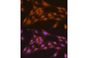 Immunofluorescence analysis of C6 cells using NRBF2 antibody  at dilution of 1:100.