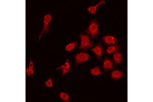 ABIN6275220 staining HepG2 by IF/ICC. (MBL2 antibody  (N-Term))