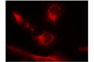 Image no. 2 for anti-Microtubule-Associated Protein tau (MAPT) (pSer356) antibody (ABIN319220) (MAPT antibody  (pSer356))
