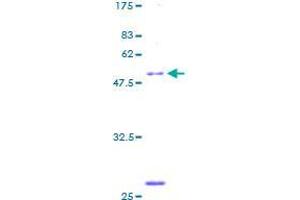 SDS-PAGE (SDS) image for UL16 Binding Protein 2 (ULBP2) (AA 1-246) protein (GST tag) (ABIN1324618) (ULBP2 Protein (AA 1-246) (GST tag))
