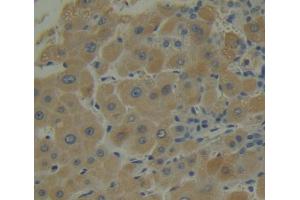 IHC-P analysis of liver tissue, with DAB staining. (SNAPIN antibody  (AA 2-136))