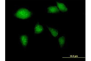 Immunofluorescence of purified MaxPab antibody to GCK on HeLa cell. (GCK antibody  (AA 1-465))