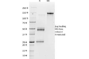 SDS-PAGE Analysis Purified Vitronectin Receptor Mouse Monoclonal Antibody (23C6).