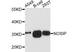 Western blot analysis of extracts of various cell lines, using NOSIP antibody (ABIN4904555) at 1:1000 dilution.