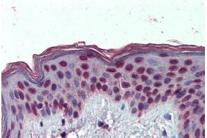 Human Skin: Formalin-Fixed, Paraffin-Embedded (FFPE) (HMGA1 antibody  (AA 9-21))