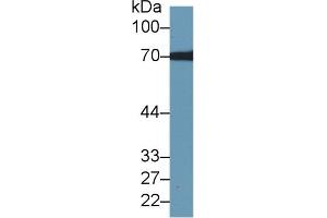 Detection of TKT in Human Hela cell lysate using Polyclonal Antibody to Transketolase (TKT) (TKT antibody  (AA 1-286))