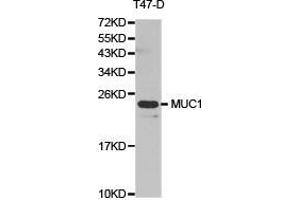 Western Blotting (WB) image for anti-Mucin 1 (MUC1) antibody (ABIN1873779) (MUC1 antibody)
