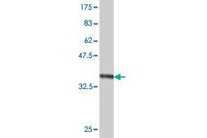 Western Blot detection against Immunogen (36. (TMPRSS3 antibody  (AA 119-214))