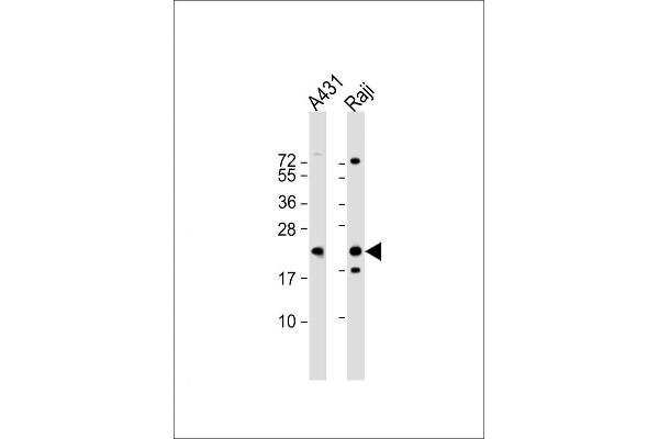 PSMB9 antibody  (C-Term)