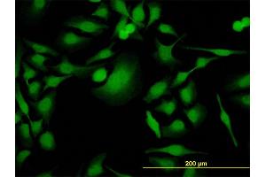 Immunofluorescence of monoclonal antibody to PBK on HeLa cell. (PBK antibody  (AA 1-110))