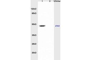Lane 1: mouse brain lysates Lane 2: mouse heart lysates probed with Anti kir 6. (KCNJ8 antibody  (AA 61-160))