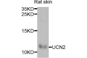 Western blot analysis of extracts of rat skin cells, using UCN2 antibody. (Urocortin 2 antibody)