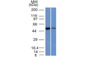 Western Blot of K562 and Lung lysate ALDH1A1 Mouse Monoclonal Antibody (ALDH1A1/1381). (ALDH1A1 antibody  (AA 315-434))