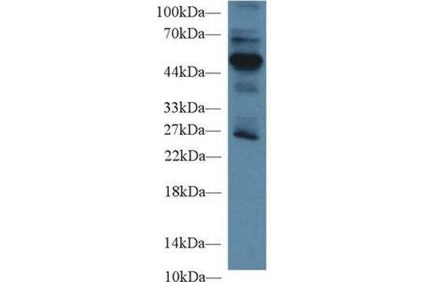 RAGE anticorps  (AA 91-274)