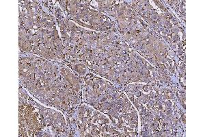IHC analysis of HLA-DRA using anti-HLA-DRA antibody (ABIN7600949). (HLA-DRA antibody  (AA 26-254))