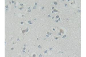 Detection of ROR2 in Human Cerebrum Tissue using Polyclonal Antibody to Receptor Tyrosine Kinase Like Orphan Receptor 2 (ROR2) (ROR2 antibody  (AA 683-934))